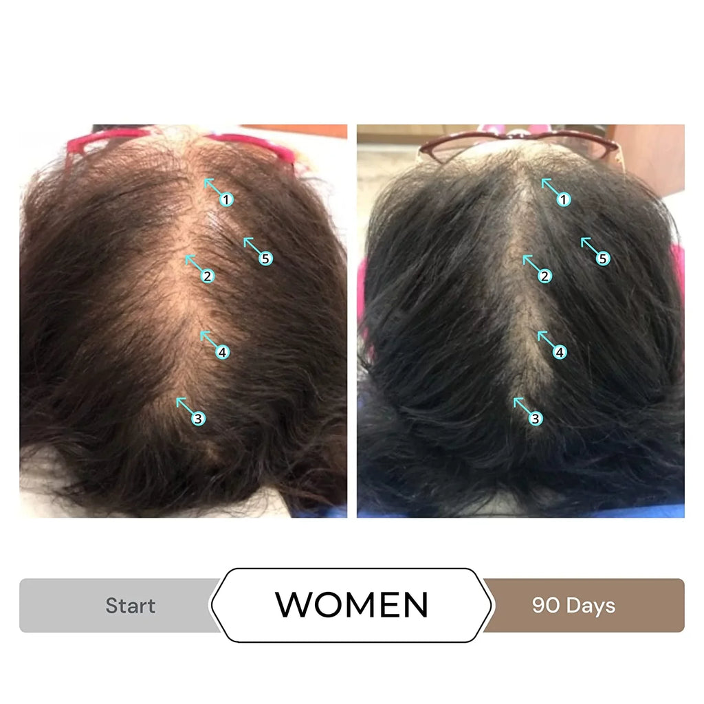 DHT w/DNC-N Shampoo Block and Nanoxidil Growth Caffeine Stimulating Hair Regrowth Treatment Ingredients, Hair 5% Helps w/Biotin, Revita